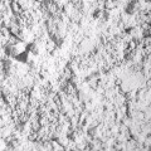 کوکائین - Cocaine